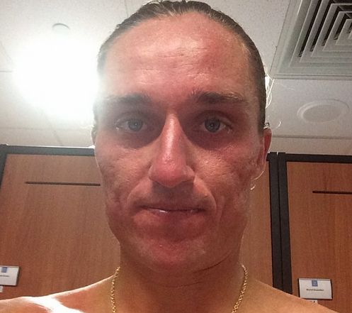 Украинский теннисист получил ожог лица на Australian Open Украинский теннисист получил ожог лица на Australian Open